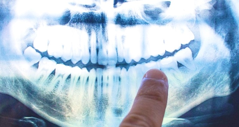  ������ ���������� ��� ������ ���������� ������� �������� ������� 