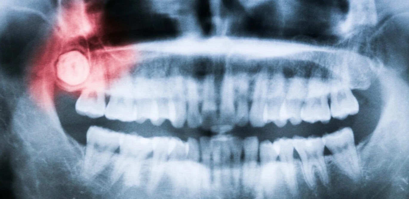  ������ �������� ������ ���� �������� �������� �������� 