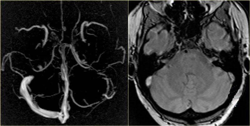  ���� �������� ������ ������������� ���������� astrazeneca ������ 