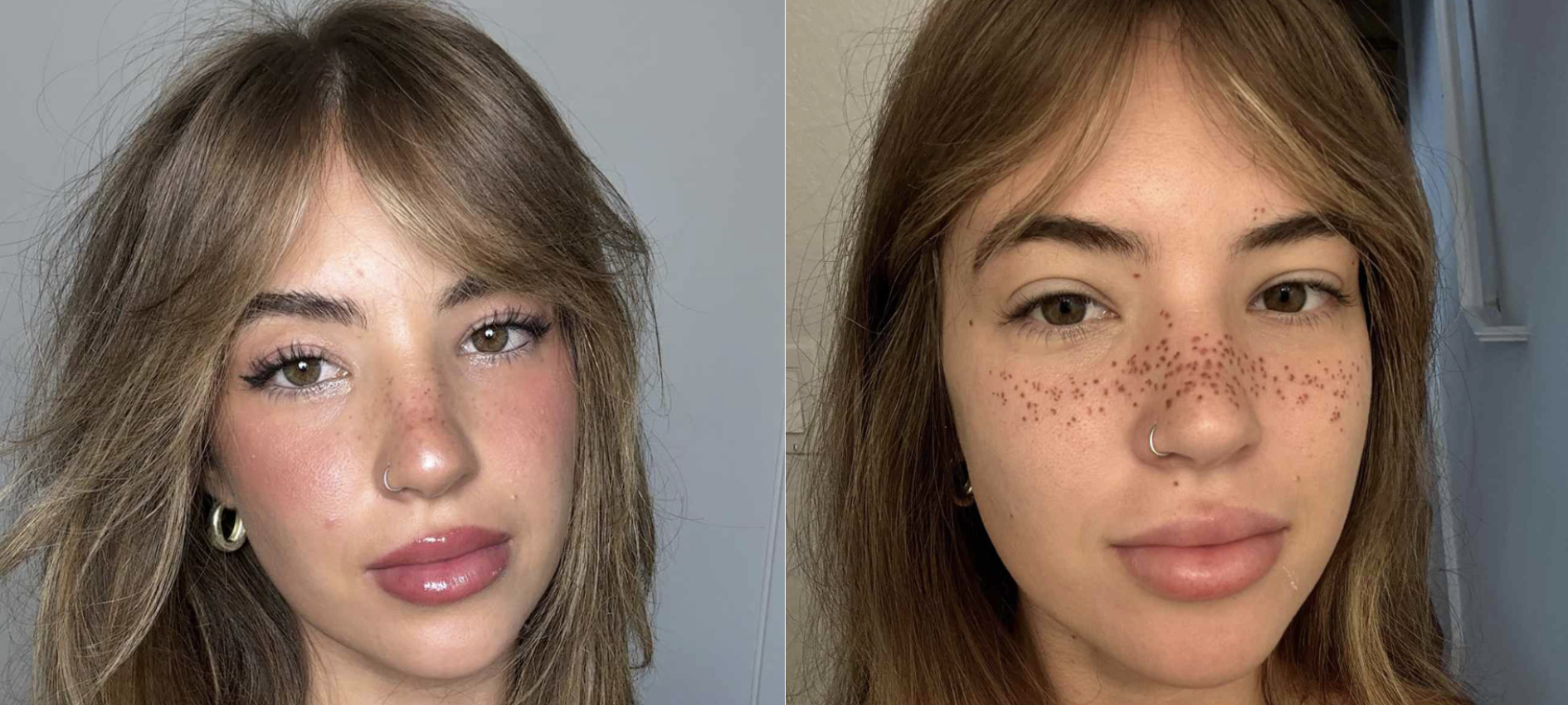 Девушка сделала тату веснушек: люди говорят, что она испортила лицо (фото)