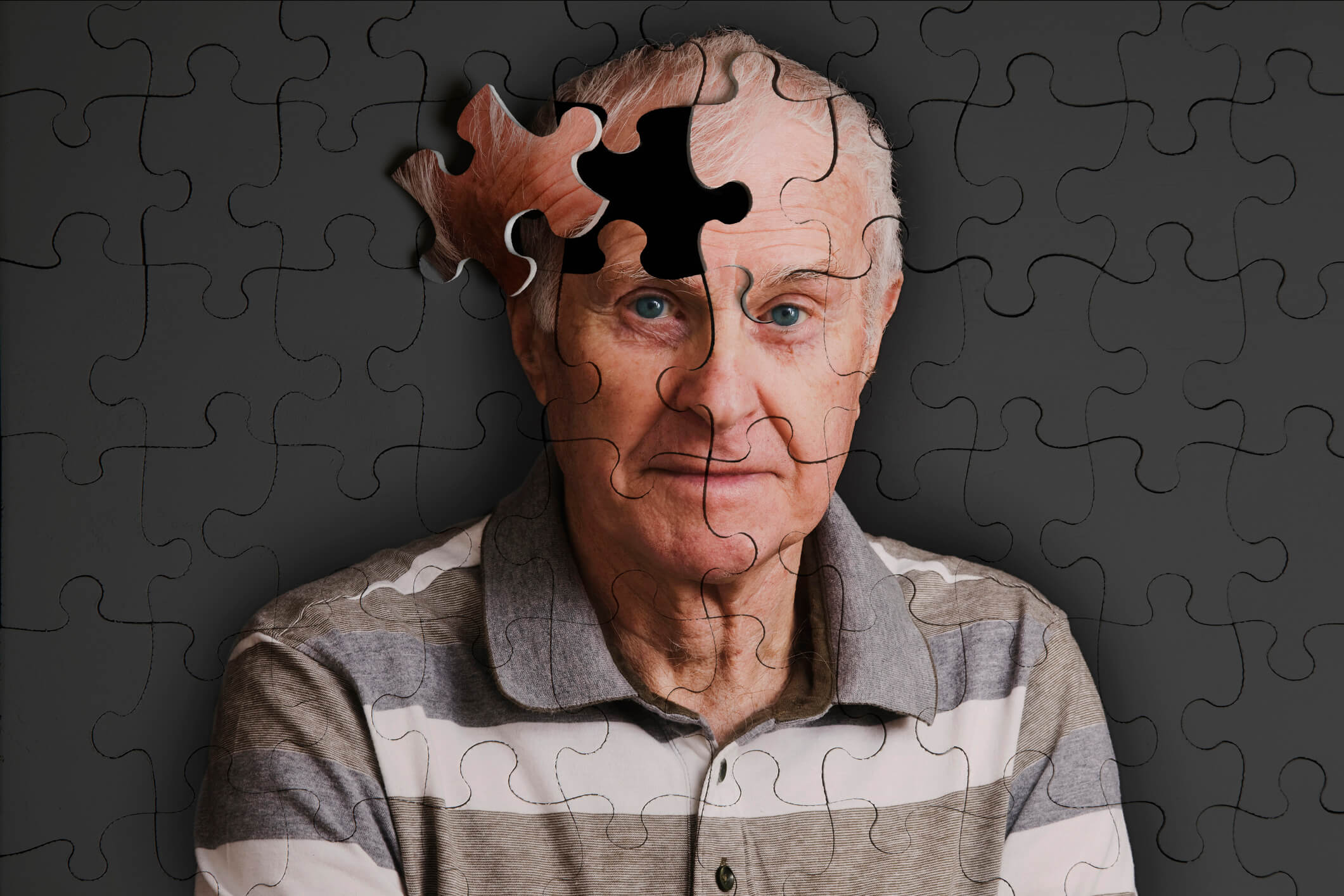 Цифровая деменция. Болезнь Альцгеймера деменция. Старческое слабоумие. Слабоумие у пожилых. Старение мозга.