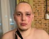 "Ми всі тут контужені": на Київщині охоронці побили ветерана ЗСУ з нервовим розладом, — ЗМІ