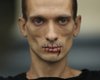 В Петербурге художник зашил себе рот в поддержку Pussy Riot