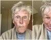 Без макияжа и с синяками под глазами: звезда фильма "101 далматинец" Гленн Клоуз сломала нос (фото)