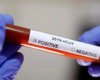 В Украину пришли тесты для диагностики коронавируса. Их хватит на 25-30 проверок