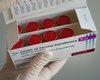 Очистка имиджа: AstraZeneca пришлось переименовать свою вакцину от коронавируса