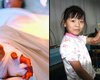 Китайской девочке оторванную руку временно пришили к ноге