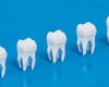 Замена пломбам и имплантам: новый материал помогает создать настоящие зубы в лаборатории