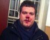 Милиция подозревает экс-свободовцев в избиении Ильенко