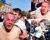 Шуфрич в драке под ОГА получил сотрясение мозга (видео)