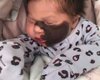 В Великобритании родилась девочка с родинкой на пол-лица (фото)