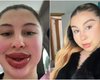 "Стала монстром": женщина пожаловалась, что ее губы все время увеличиваются (фото)