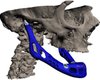 Врачи напечатали на 3D-принтере человеческую челюсть