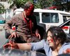 Количество жертв теракта в Кабуле возросло до 150 человек