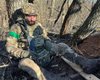 Зірка "Ліги сміху" Віктор Розовий показав наслідки трепанації черепа після важкого поранення