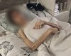 30 кг веса при росте 180 см: в Одессе отец "лечил" подростка от "нечистых бесов" (фото, видео)