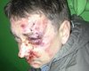 В Сумах жестоко избит активист и журналист Евгений Положий