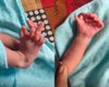 Реінкарнація богині: в Індії народилася дівчинка з 26 пальцями на руках і ногах (відео)