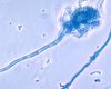 Ученые бьют тревогу: на 90% смертельный грибок массово находят на задних дворах (фото)