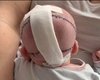 Нарастили череп: в Польше ребенку спасли жизнь, сделав уникальную операцию (фото)