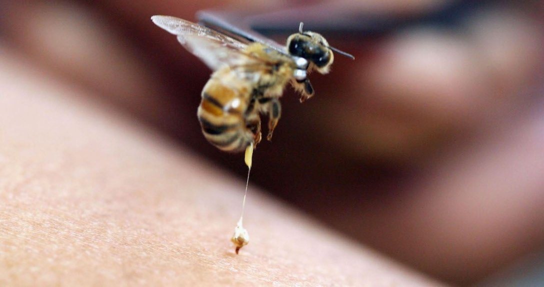 пчела, жало, кожа человека, фото
