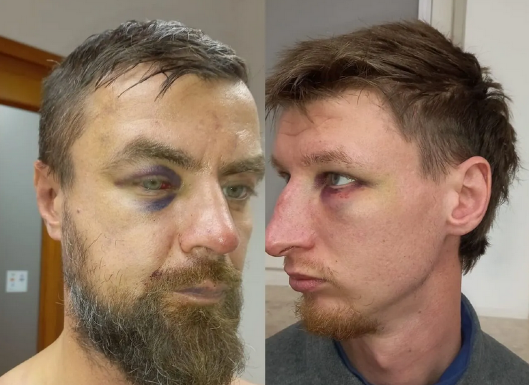 In Warsaw, police beat two Ukrainians due to a conflict with the Poles