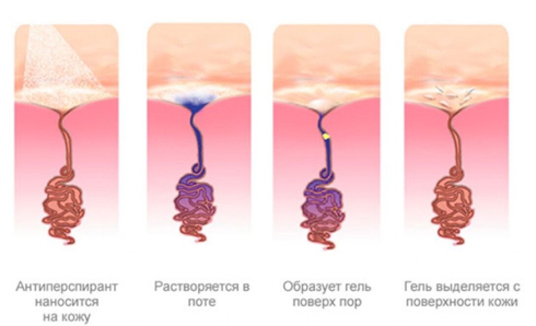 Профузное потоотделение. Вредные вещества удаляются из организма. Что выходит через пот. Что выходит через пот. Что выходит через пот.