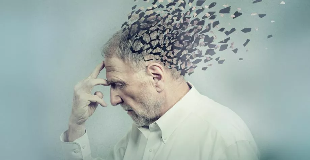 болест на Алцхаймер, мозък, човек, човек