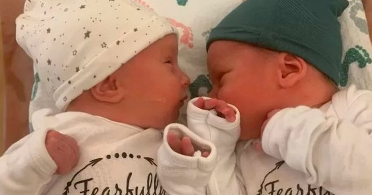 Когда их первый раз увидели, внешний вид детей шокировал даже опытных врачей. Аномалия проявилась при рождении, когда уже стало понятно, что костная ткань у младенцев гораздо хрупче обычного. Переломы можно было получить даже при легком массаже или прикосновении, что в корне изменило жизнь всей семьи.