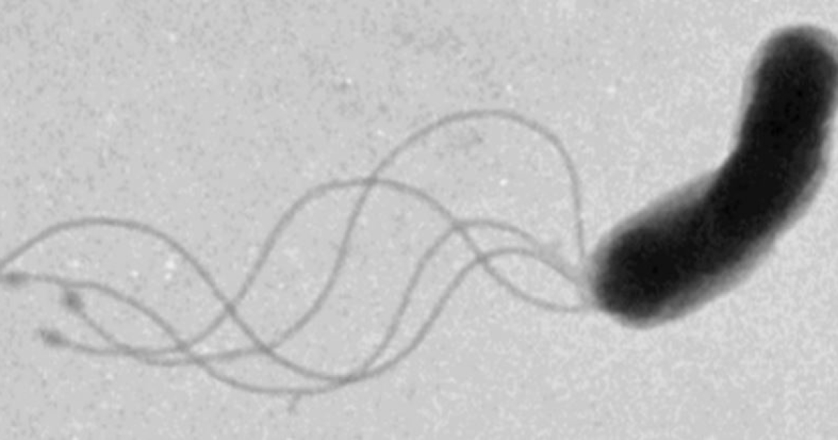 Маленькие Карлсоны с пропеллерами. Ученые разгадали загадку движения бактерий, на это ушло 50 лет
