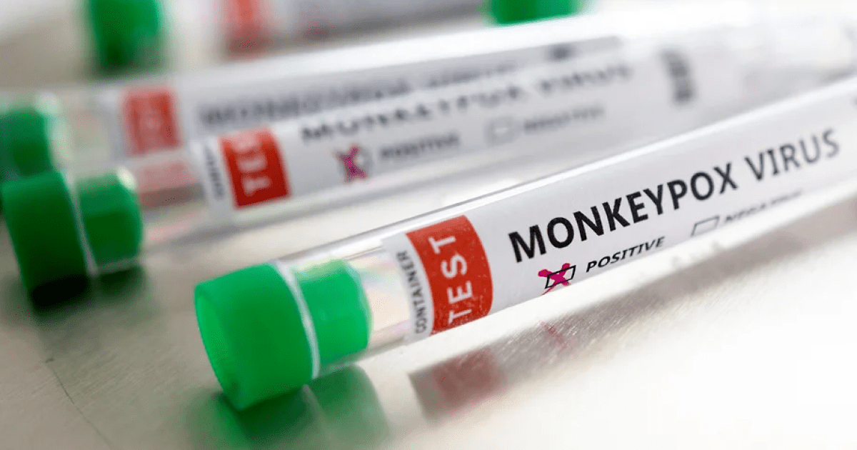 5 минут назад В МОЗ собрали всю информацию о вирусе обезьяньей оспы: диагностирование, симптомы и профилактика (ИНФОГРАФИКА)