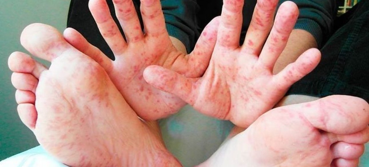 Фото: Etcetera.media