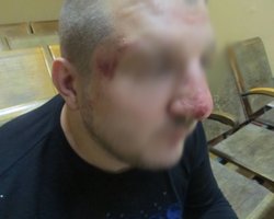 Российские пограничники избили украинца, - ГПСУ