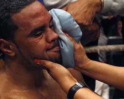 Чемберс получил сотрясение мозга в бою с Кличко