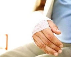 Власти готовы платить киевлянам за переломы и сотрясения