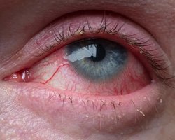 Понад 60 років тому підліток підкинув монетку і не спав 11 днів: наслідки дуже тривожні