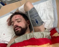 "Способен на подвиги": почему лаборант Бильченко выпрыгнул из авто и какие имеет травмы, — СМИ (видео)