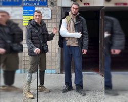 В Одесі військовому зламали руку під час спроби силової мобілізації: ветерани вимагають контролю за ТЦК