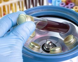 Во Франции появился штамм COVID-19, который "не видят" ПЦР-тесты