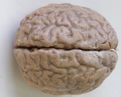 Мозг Майкла Джексона еще не вернули родственникам