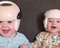 Близнецы проводят в шлемах 23 часа в сутки: мама все объяснила (видео)