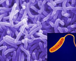 В Венесуэле холерой заболели  239 человек