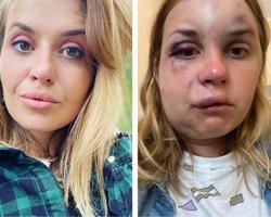 Жертва насильника из поезда "Киев-Мариуполь" показала новое фото