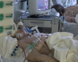 Статистика коронавірусу на 18 квітня: померли 250 осіб, число нових випадків продовжує скорочуватися