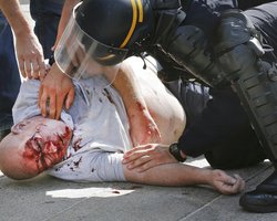 Английский фанат, избитый российскими болельщиками в Марселе, пережил клиническую смерть, - СМИ