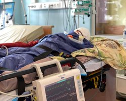 Обгорело лицо, осколки в черепе: показали мальчика, который пострадал во время удара по Виннице (фото)