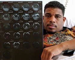 Солис: никакой удар Кличко меня не потряс