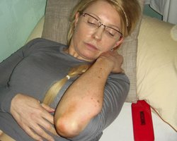 Комитет по предотвращению пыток представил отчет о сопротивлении Тимошенко при перевозке в больницу - Ъ