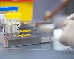 "Британский" штамм коронавируса выявлен в Винницкой и Закарпатской областях