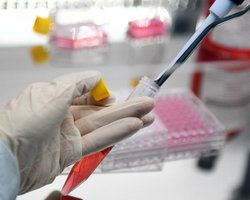 Омикрон уже в Украине. Первый случай выявили у прилетевшего из ОАЭ, — Минздрав